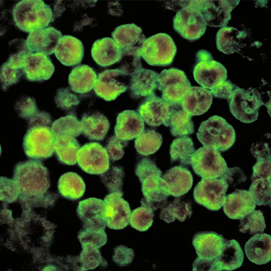 Protect Yourself From The Deadly Brain Eating Amoeba